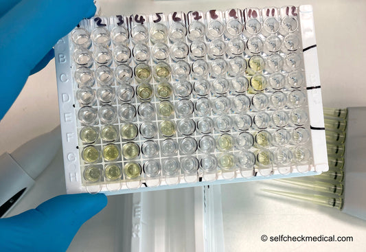 ELISA 96 well plate showing graduated standard curve in triplicate and patient samples in duplicate. Wells are various shade of yellow which is proportional to the amount of analyte detected.